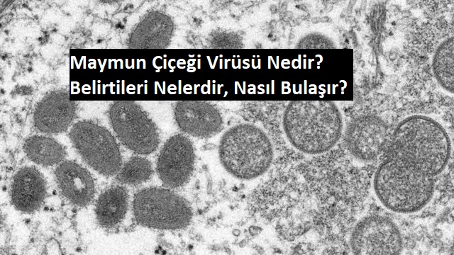 Maymun Çiçeği Virüsü Nedir? Belirtileri Nelerdir, Nasıl Bulaşır?